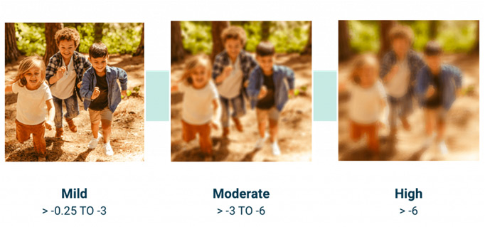 근시진행 억제란